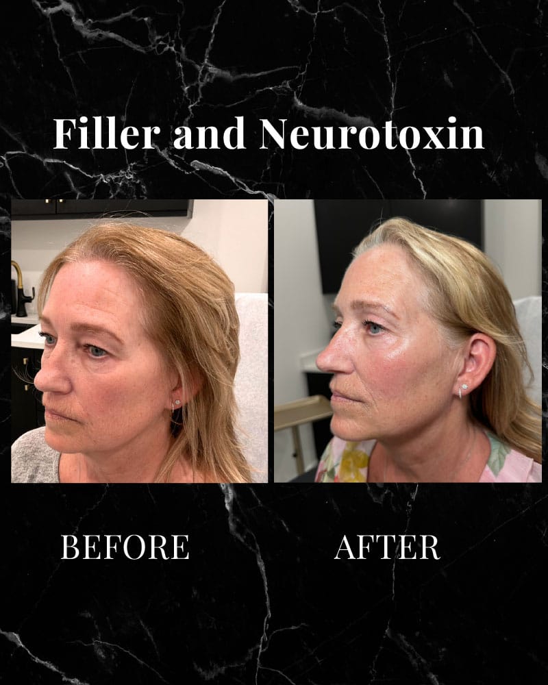 Before and After 4
