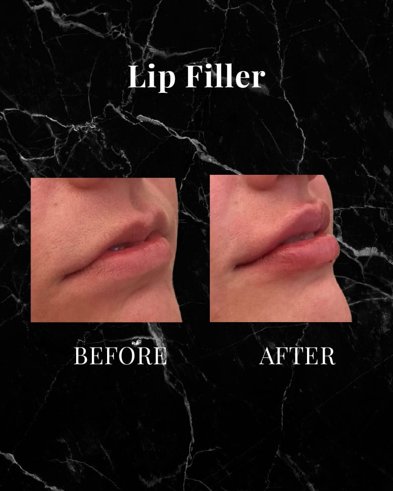 Before and After 5