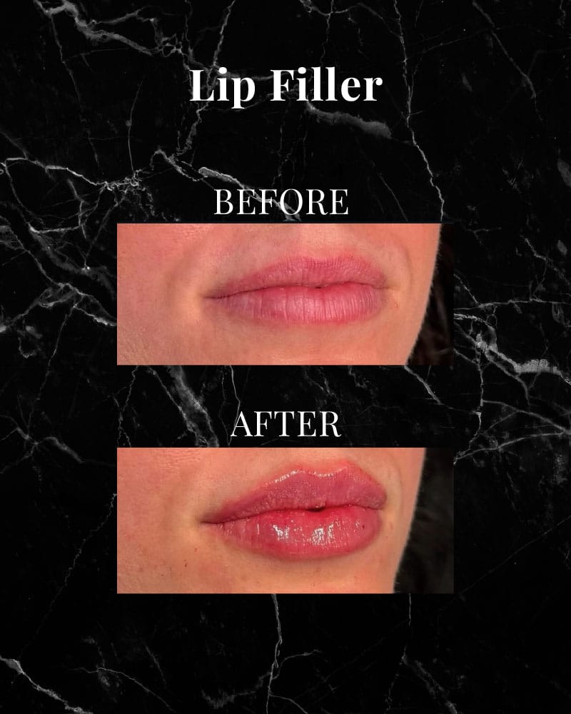Before and After 3