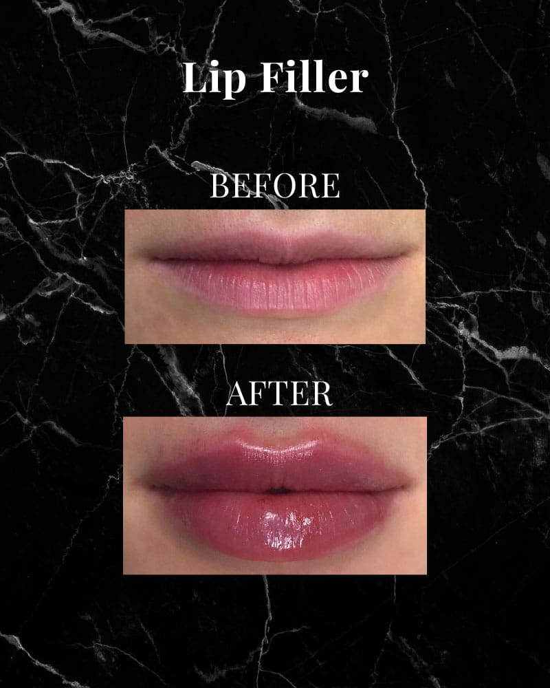 Before and After 2