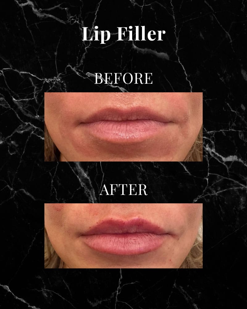 Before and After 1